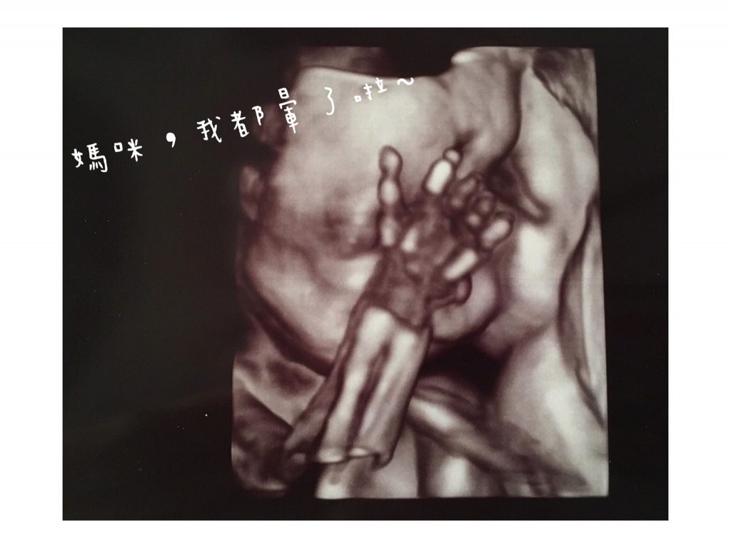 鴨肉太太 高層次超音波 寶寶的廬山真面目之媽咪我很好 農純鄉 鴨肉太太 高層次超音波 寶寶的廬山真面目之媽咪我很好 農純鄉